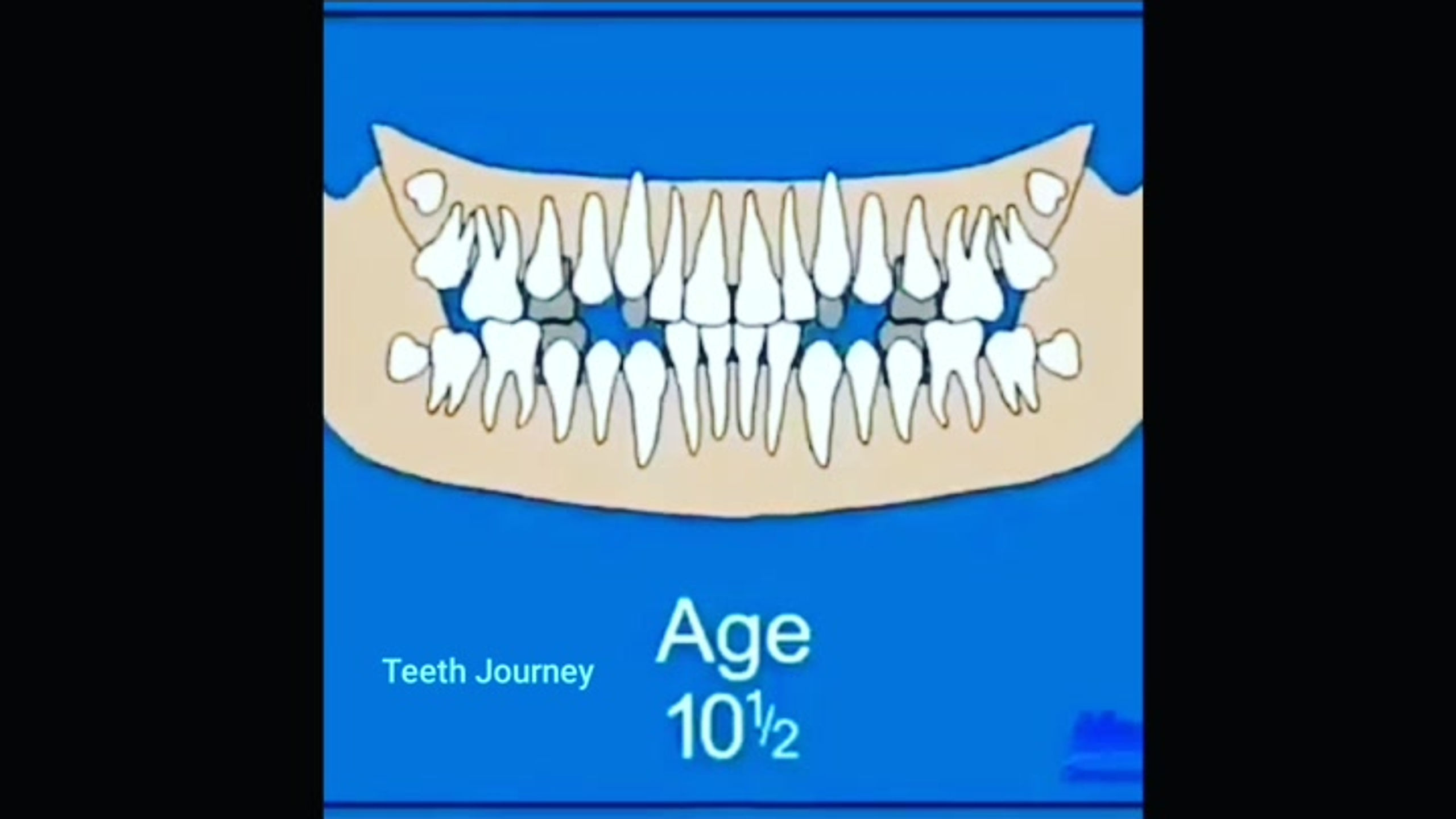 teeth journey